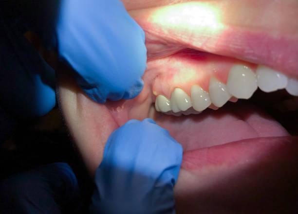 Best Tooth Pain Emergency Relief  in Whitefish, MT