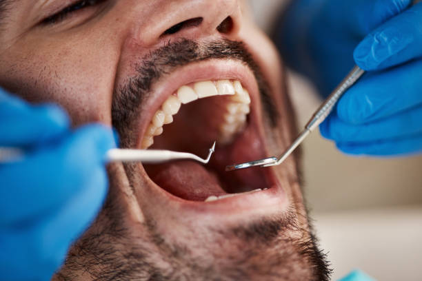 Best Dentist for Tooth Abscess  in Whitefish, MT